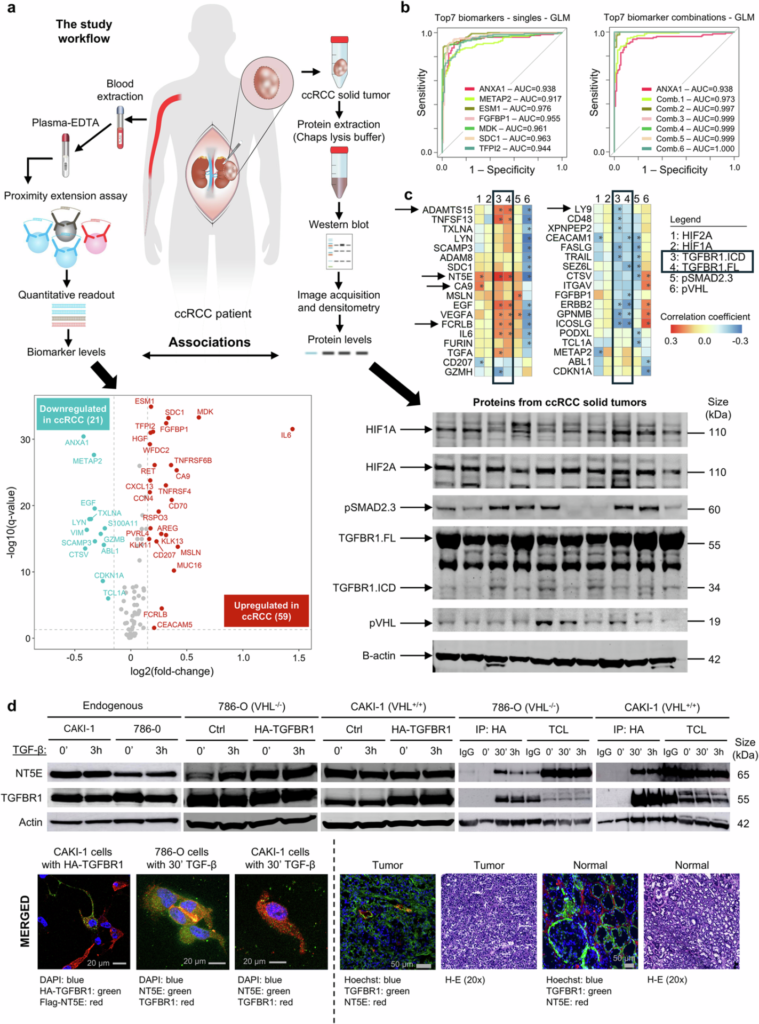 Figure from “Liquid biomarkers associate with TGF-β Type I receptor and hypoxia in kidney cancer” (Mallikarjuna et al., 2025), published in Signal Transduction and Targeted Therapy. DOI: 10.1038/s41392-025-02404-7